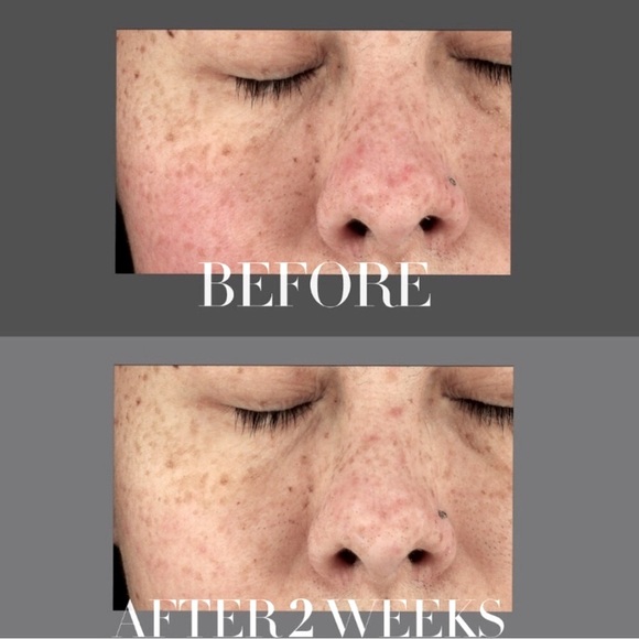 Rich power cream Kate Somerville ceuticals - Picture 2 of 9